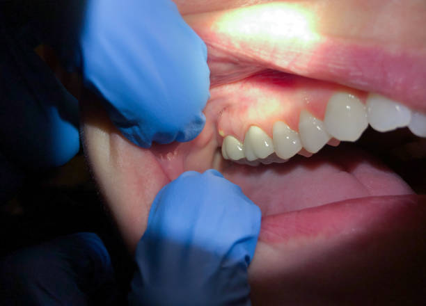 Best Emergency Dental Care for Trauma or Injury in Des Allemands, LA